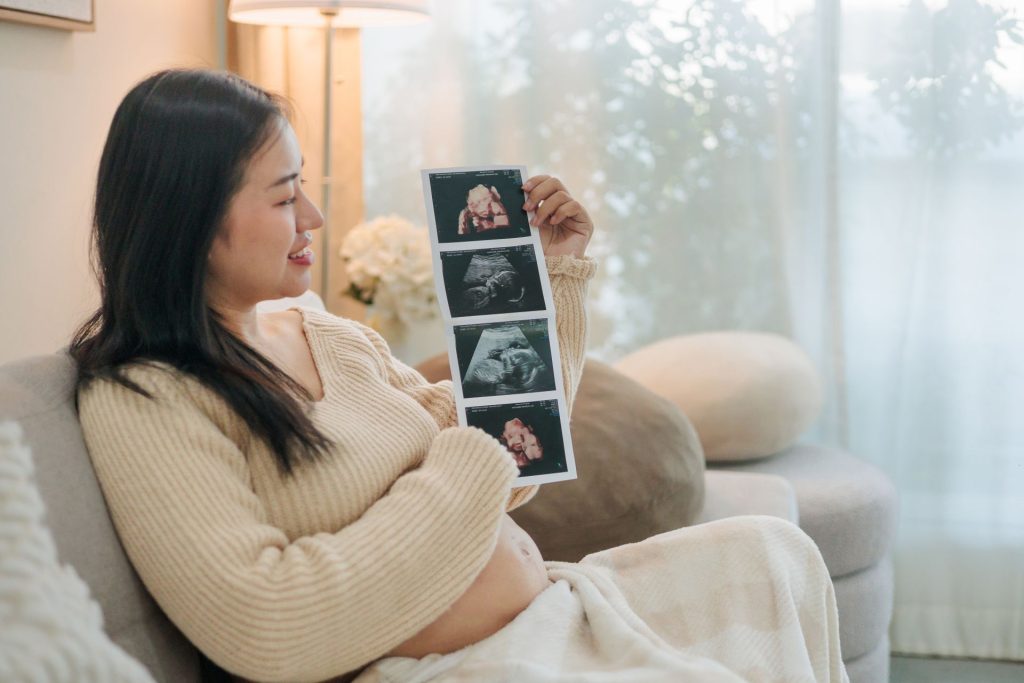 Women holding series of photos from recent ultrasound of baby